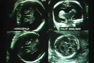 El Hospital de Fuenlabrada analiza los mtodos para la deteccin precoz de problemas en la formacin del feto. 